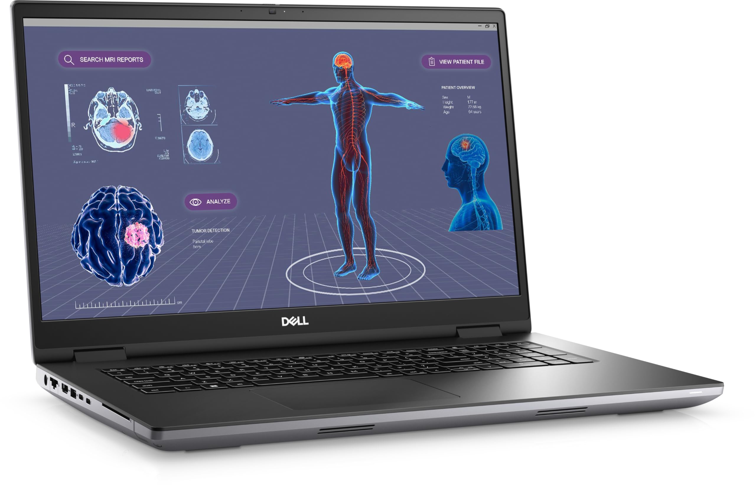 Dell Precision 7780 17.3 FHD, i7-13850HX (20 Cores), Nvidia RTX 3500 ADA 12GB, 2TB PCIe Gen 4.0x4 NVMe, 32GB DDR5, SD & Smartcard Reader, GbE, WIFI 6E & BT, UK Backlit Keys, Windows 11 Pro (Renewed)
