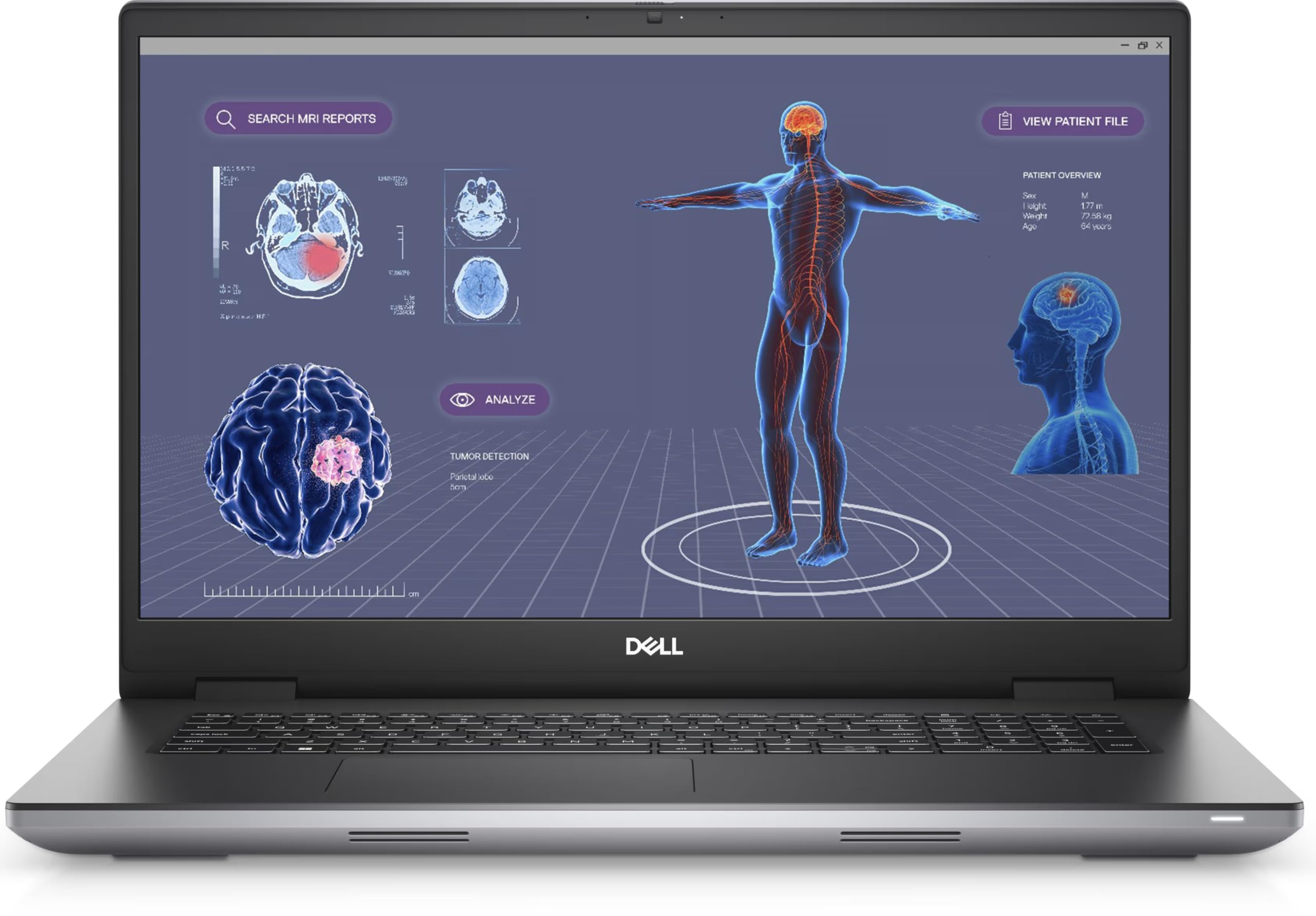 Dell Precision 7780 17.3 FHD, i7-13850HX (20 Cores), Nvidia RTX 3500 ADA 12GB, 2TB PCIe Gen 4.0x4 NVMe, 32GB DDR5, SD & Smartcard Reader, GbE, WIFI 6E & BT, UK Backlit Keys, Windows 11 Pro (Renewed)