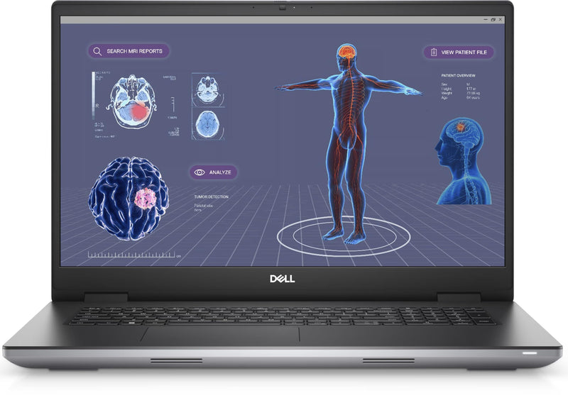 Dell Precision 7780 17.3" FHD, i7-13850HX (20 Cores), Nvidia RTX 3500 ADA 12GB, 2TB PCIe Gen 4.0x4 NVMe, 32GB DDR5, SD & Smartcard Reader, GbE, WIFI 6E & BT, UK Backlit Keys, Windows 11 Pro (Renewed)