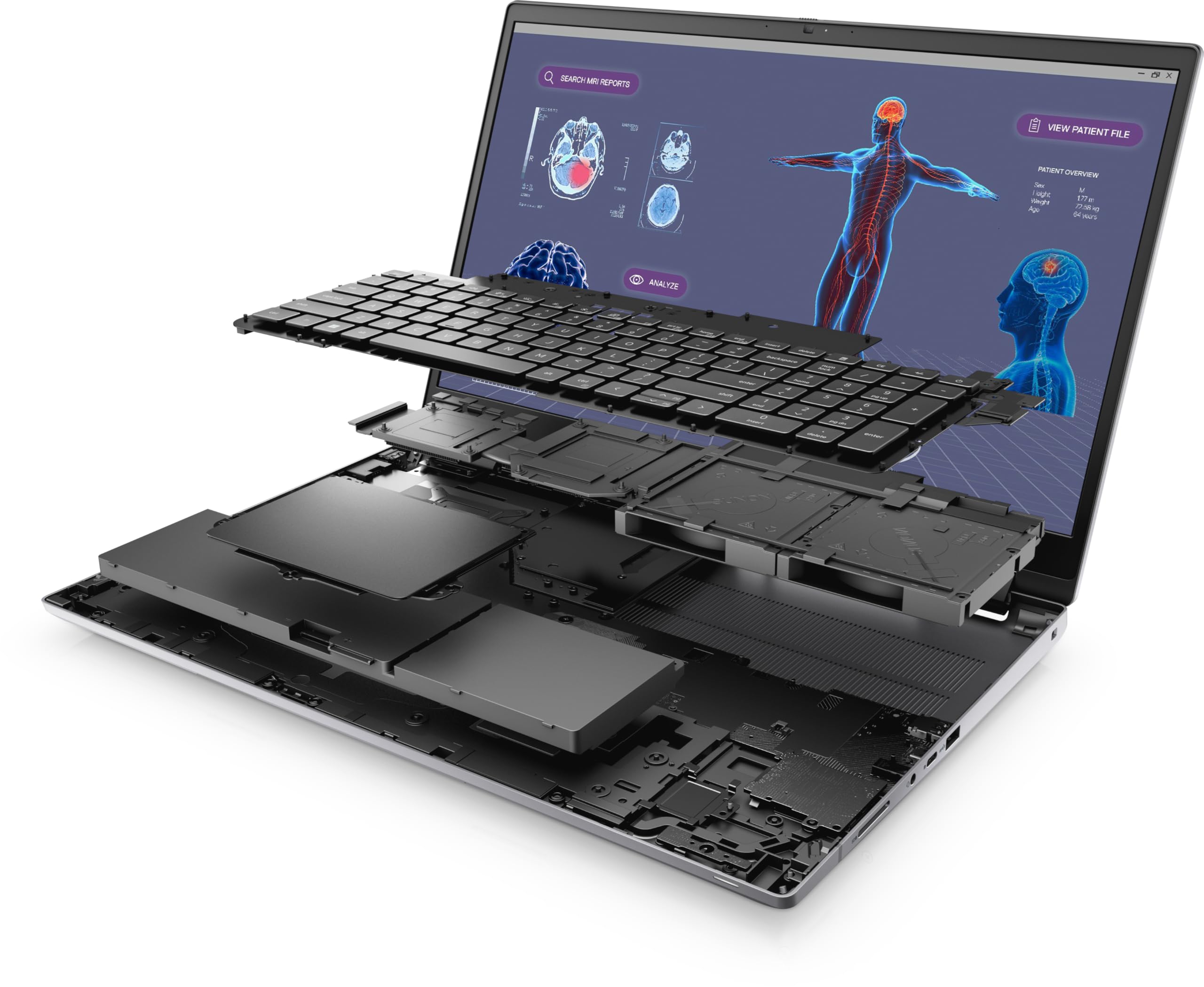 Dell Precision 7780 17.3 FHD, i7-13850HX (20 Cores), Nvidia RTX 3500 ADA 12GB, 2TB PCIe Gen 4.0x4 NVMe, 32GB DDR5, SD & Smartcard Reader, GbE, WIFI 6E & BT, UK Backlit Keys, Windows 11 Pro (Renewed)